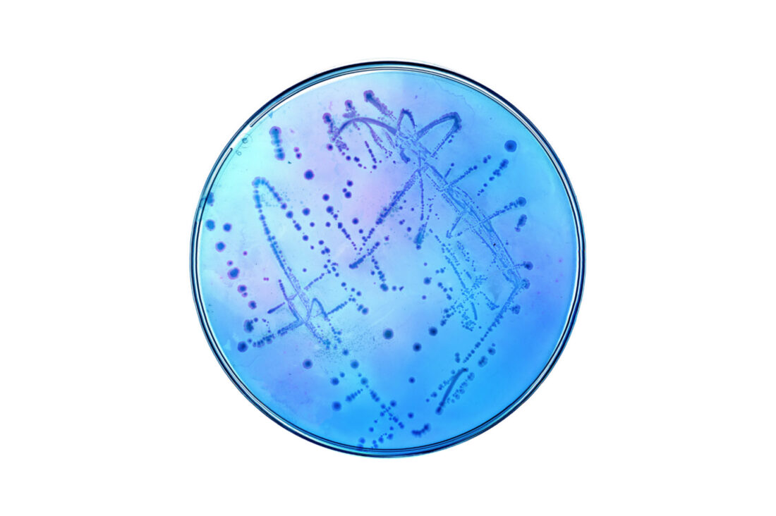 A blue agar plate with slight bacterial growth